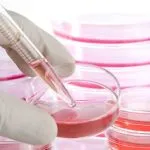 stem cell therapy