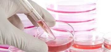 stem cell therapy
