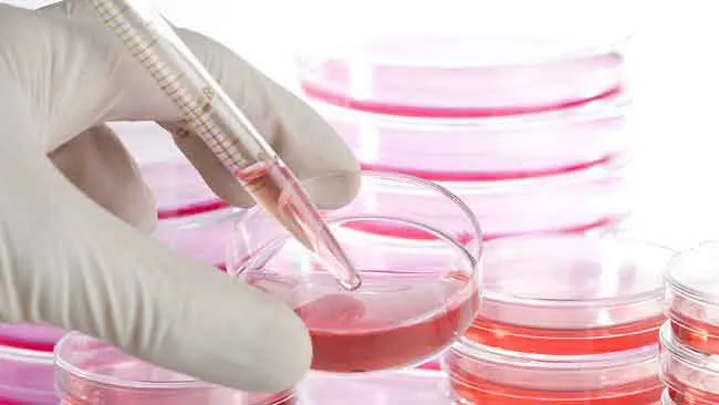 stem cell therapy