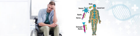 Multiple Sclerosis Stem Cell Treatment in India