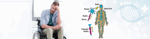 Multiple Sclerosis Stem Cell Treatment in India