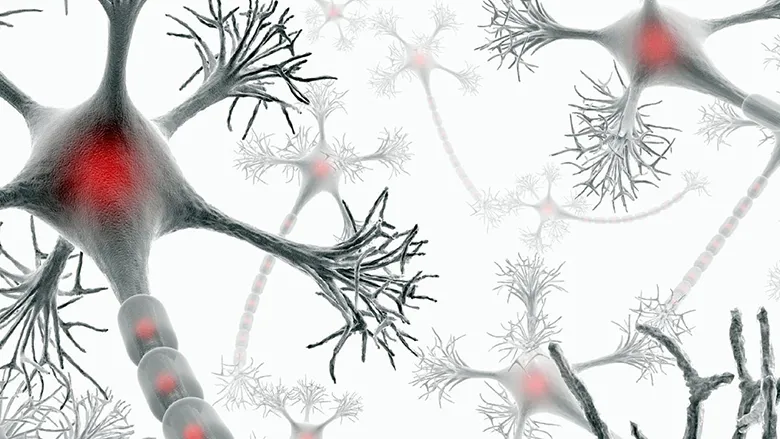 Multiple Sclerosis