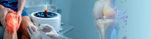 Osteoarthritis Stem Cell Treatment in Delhi, India