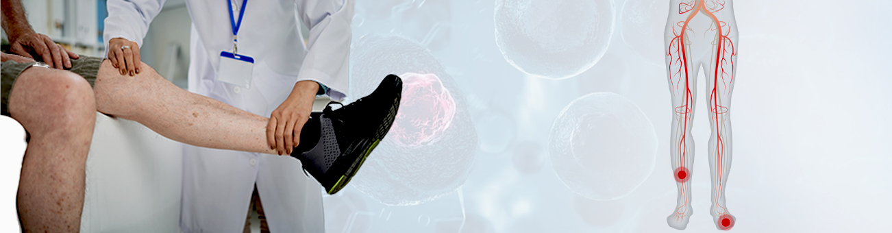 Stem Cell Treatment for Critical Limb Ischemia (CLI) in India