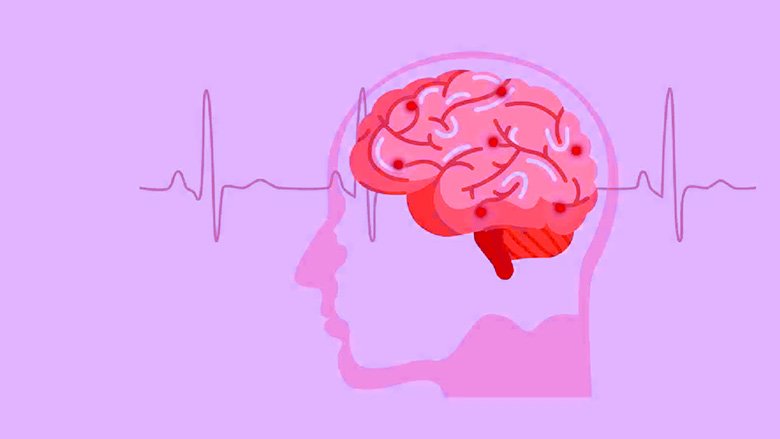 Stroke Stem Cell Treatment