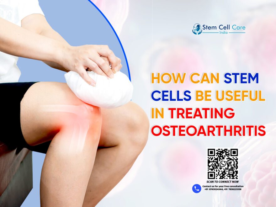 How Can Stem Cells be Useful in Treating Osteoarthritis?