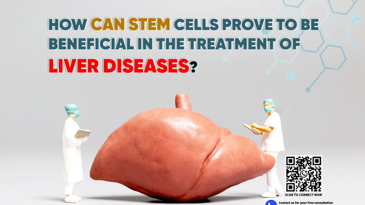 How Can Stem Cells Prove to be Beneficial in the Treatment of Liver Diseases?