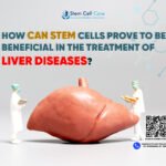 How Can Stem Cells Prove to be Beneficial in the Treatment of Liver Diseases?