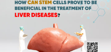How Can Stem Cells Prove to be Beneficial in the Treatment of Liver Diseases?