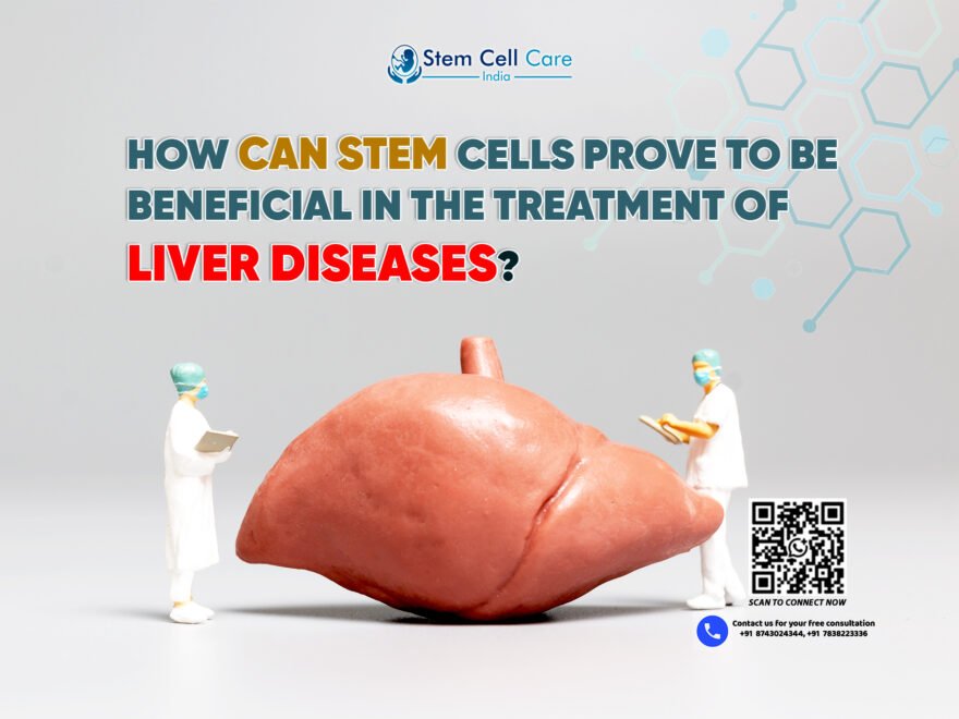 How Can Stem Cells Prove to be Beneficial in the Treatment of Liver Diseases?