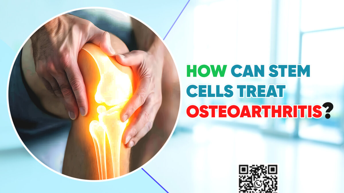 How Can Stem Cells Treat Osteoarthritis?