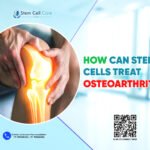 How Can Stem Cells Treat Osteoarthritis?