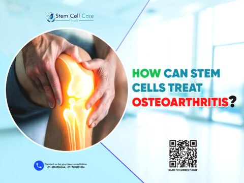 How Can Stem Cells Treat Osteoarthritis?