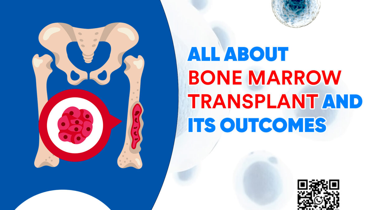 All About Bone Marrow Transplant and Its Outcomes