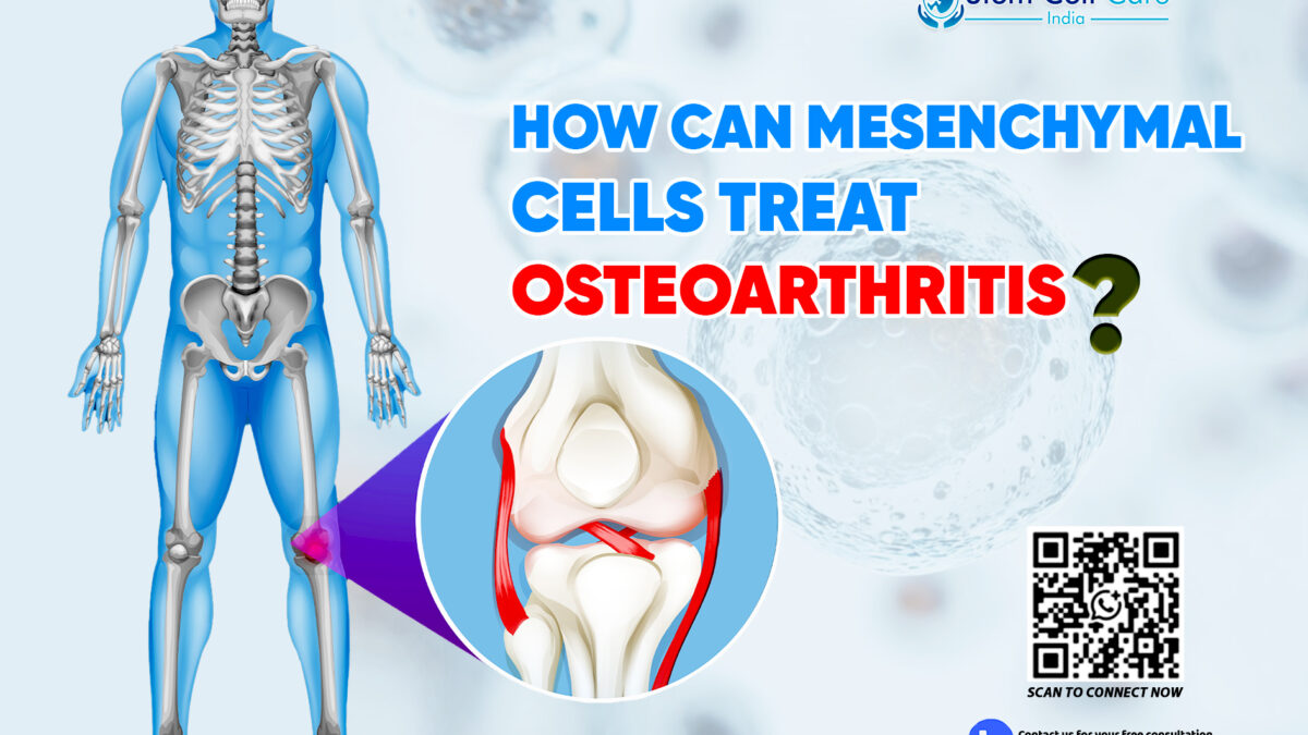 How Can Mesenchymal Cells Treat Osteoarthritis?