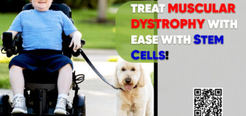 Treat Muscular Dystrophy With Ease with Stem Cells!