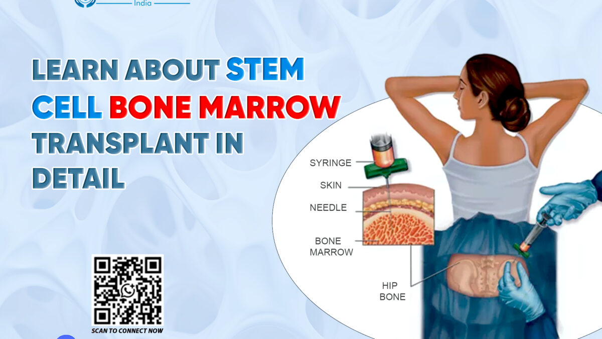 Learn About Stem Cell Bone Marrow Transplant in Detail