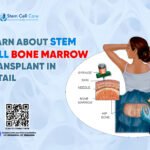 Learn About Stem Cell Bone Marrow Transplant in Detail