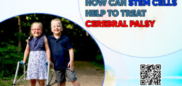 How Can Stem Cells Help to Treat Cerebral Palsy