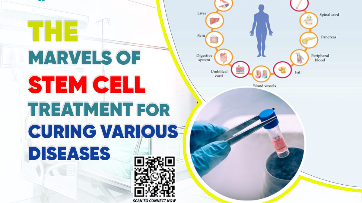 The Marvels of Stem Cell Treatment for Curing Various Diseases