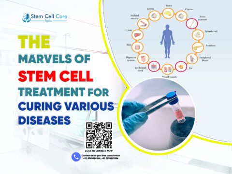 The Marvels of Stem Cell Treatment for Curing Various Diseases