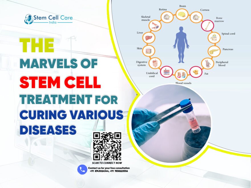 The Marvels of Stem Cell Treatment for Curing Various Diseases