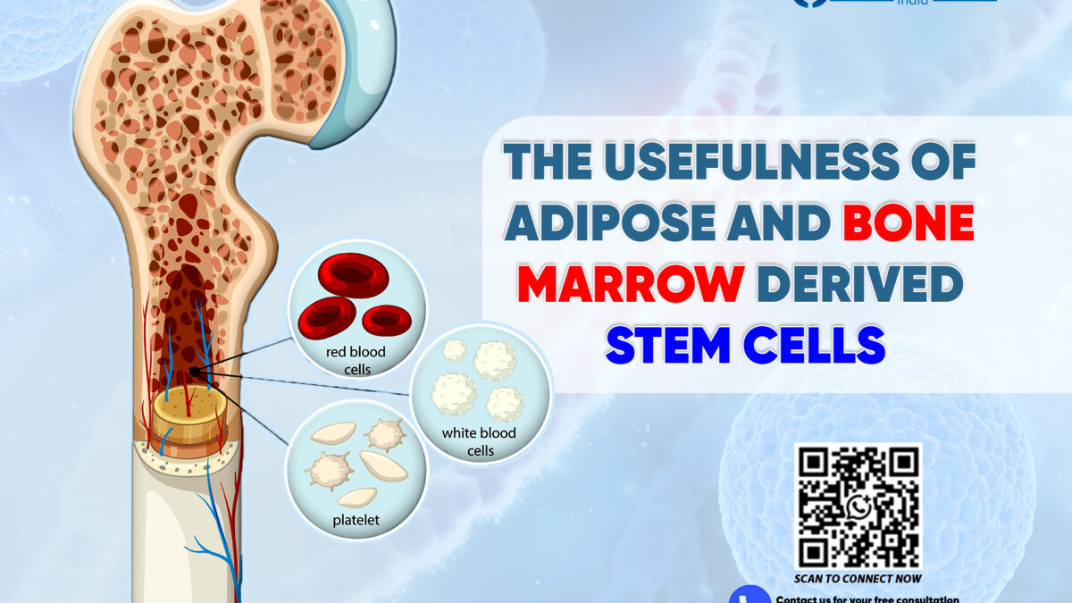 The Usefulness of Adipose and Bone Marrow Derived Stem Cells