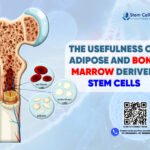 The Usefulness of Adipose and Bone Marrow Derived Stem Cells