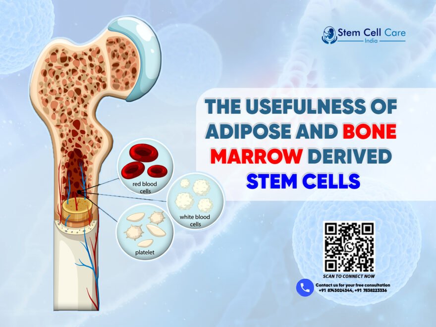 The Usefulness of Adipose and Bone Marrow Derived Stem Cells