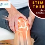 Stem Cell Treatment for Arthritis and Osteoarthritis