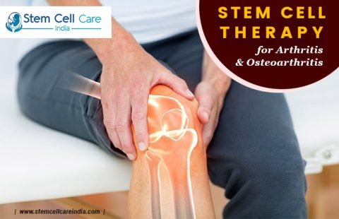 Stem Cell Treatment for Arthritis and Osteoarthritis