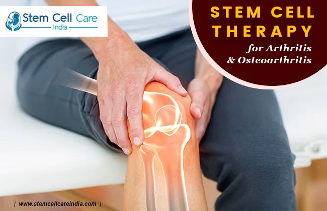 Stem Cell Treatment for Arthritis and Osteoarthritis