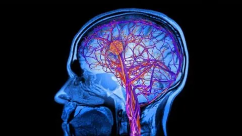 Stem Cell Treatment of Neurodisorder in India
