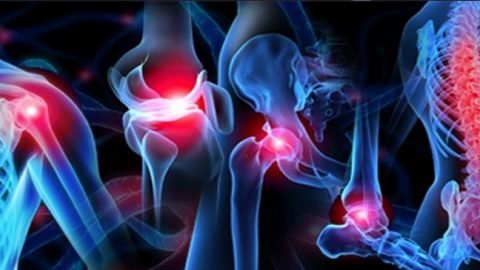 Orthopaedic