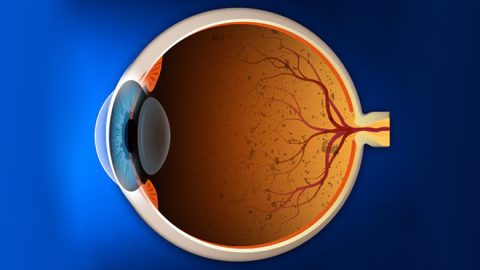 Stem Cell Treatment for Retinitis Pigmentosa Delhi, India
