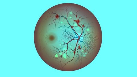 Stem Cell Treatment for Retinopathy