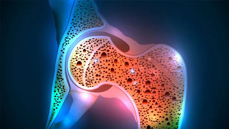 Stem-Cell-Treatment-Osteoporosis Stem Cell Treatment Osteoporosis