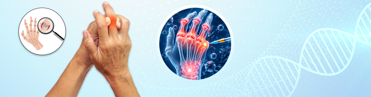 Stem Cell Treatment Rheumatoid Arthritis in Delhi, India