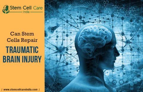 Can Stem Cells Repair Traumatic Brain Injury