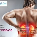 stem cell therapy for chronic kidney disease