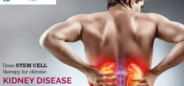 stem cell therapy for chronic kidney disease