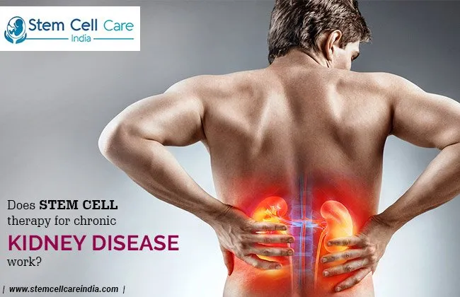 stem cell therapy for chronic kidney disease