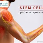 Stem cell optic nerve regeneration