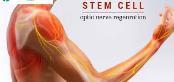 Stem cell optic nerve regeneration