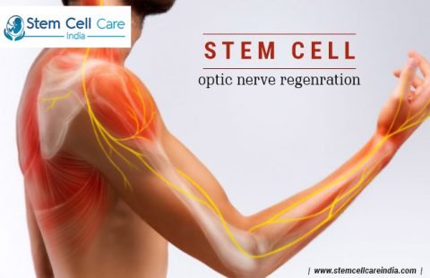 Stem cell optic nerve regeneration