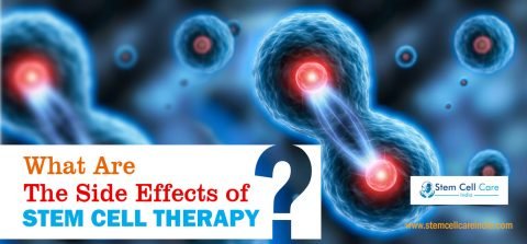 What Are the Side Effects of Stem Cell Therapy