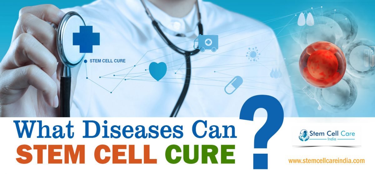 What are the Diseases that Stem Cells Can Treat and How? Home