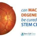 macular degeneration