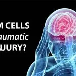 Can Stem Cells Repair Traumatic Brain Injury