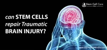 Can Stem Cells Repair Traumatic Brain Injury